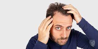 **why is my hair falling? 6 Questions That You Must Ask About Hair Regrowth And How To Control Hair Loss At Ahs Ahs Uae