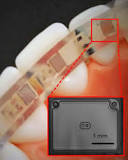 Flexible battery - Wikipedia