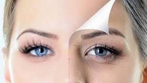 Can sleep wrinkles be removed? Dark Circles 10 Home Remedies That Always Work