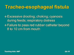 Drooling is when saliva unintentionally flows outside of your mouth. Danger Signs In Newborn Ppt Video Online Download