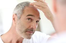 Although the exact cause of at is unknown, it is thought to be an autoimmune condition in which the immune system mistakenly attacks the hair follicles. Male Pattern Baldness Causes And Treatment