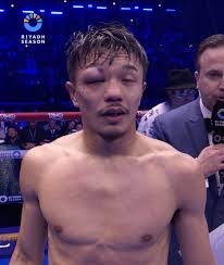 Junto Nakatani PANALO sa score na 115-113 at 118-110. Pero kumbinsido ang  karamihan na sapat na ang ginawa ni Sebastian Hernandez para makuha ang  panalo lalo pa't binugbog nito si Nakatani sa