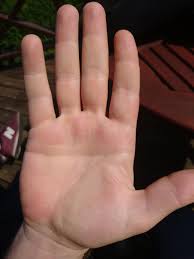 Their positive and decisive character benefits the career development. My Brother Has A Simian Line Pretty Rare Any Thoughts On This Palmistry