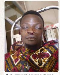 One person died in the accident (tumble motor) May his soul rest in peace  (UDUS student)