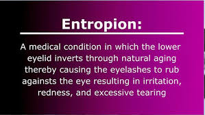 Image result for Entropion