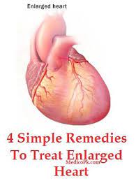 4 Simple Remedies To Treat Enlarged Heart Enlarged Heart Prostate Health Remedies Remedies