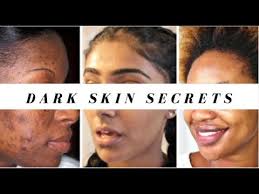 Areas of skin can darken after people have had inflammation of the skin. Darker Skin Tones How To Get Rid Of Hyperpigmentation 3 Steps Extrashade