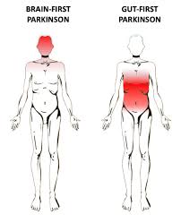 The disorder affects several regions of the brain, especially an area called the substantia nigra that controls balance and movement. Where Does Parkinson S Disease Start In The Brain Or Gut Or Both Journal Of Parkinson S Disease