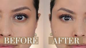 Bags under the eyes are actually a herniation, or an abnormal protrusion, of the fat pads surrounding the eye. How To Conceal Dark Circles 2020 Updated Routine Tips On How To Get It Right Youtube