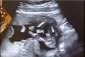 5 perkembangan janin 2 bulan sudah membentuk organ reproduksi pada embrio tidak hanya itu saja kartilago dan tulang pun juga terbentuk. Kapan Kelamin Janin Bisa Di Usg