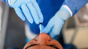 A través de una muestra nasofaríngea. Alemania Dona A Ecuador 100 000 Pruebas Pcr Para Covid 19 Y Confirma Visita De Epidemiologos El Comercio