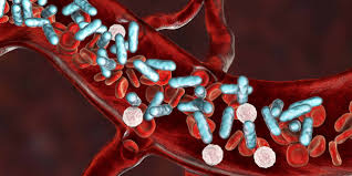 This initial stage is followed by suppression of the immune system. Faq Antworten Auf Die Haufigsten Fragen Rund Um Das Thema Sepsis