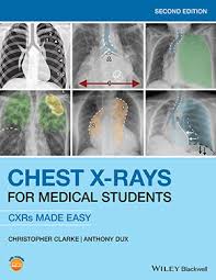 Image result for XRay Interpretation