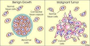Pin On Nursing Cancer