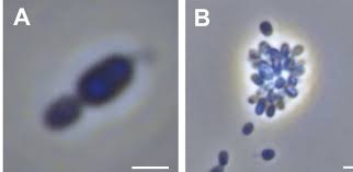 Image result for Asplenium markusbeckeri