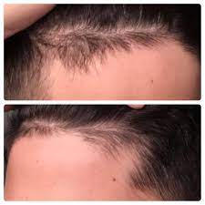 Pin On Hair And Style