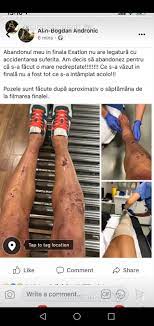 Exploitation of bogdan andronic's research while affiliated with universitatea danubius galati and other places. Alin Andronic Posts Facebook