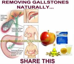 Www Sefindia Org View Topic Removing Gallstones Naturally Gallbladder Cleanse Gallbladder Health