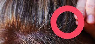 Melasse ist ein gutes hausmittel für graue haare. Graue Haare 3 Grunde Warum Du Sie Nicht Farben Solltest Utopia De