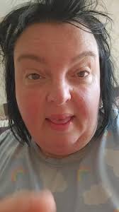 Adrienne Mathis Sleep Apnea