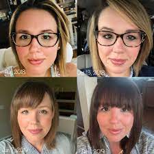 Your hair's normal transition from the anagen to telogen phase is sometimes expedited due to stress. Keto And Hair Loss The Beauty Secret Of The Keto Diet Keto In Pearls