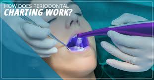 Dental Implants Seattle How Does Periodontal Charting Work