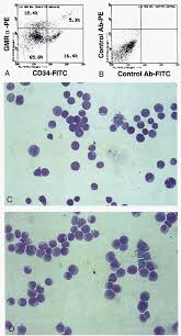 Expression and Function of the Human Granulocyte-Macrophage  Colony-Stimulating Factor Receptor α Subunit