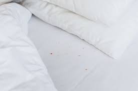 Image result for bed bugs droppings