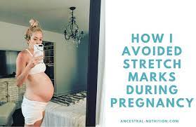 How To Prevent Stretch Marks During Pregnancy - Ancestral Nutrition