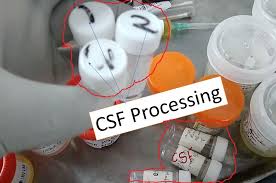 Image result for CSF Culture