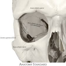 Lateral Wall Of The Orbit Medical Anatomy Head Anatomy Skull Anatomy