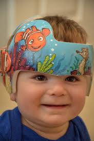 Nemo Band DOC band/Cranial Band/Helmet  https://www.facebook.com/Cranial-BandsMurals-by-Leigh-Gibson-153150921414230/