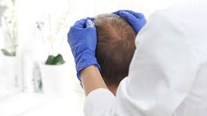 Oz investigates hair loss scams targeting women watch more on the dr. Ingredient Betaine Found In Coconut Recipe For Hair Growth Doctor S Notes Tricovit Hair Care