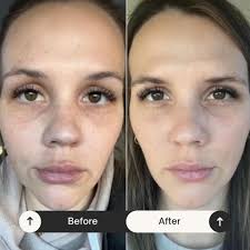 Rachel Coker Medical Aesthetics