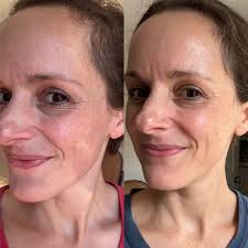 Is there a natural supplement that is good for anxiety? I'be recently  started working out daily, which helps some, but I'm a teacher and coach  and just having a tough time with