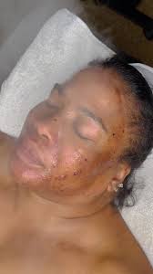 Dermaplaning + Blueberry Enzyme + steam...