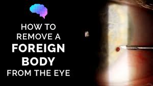 Image result for Eye Foreign Body