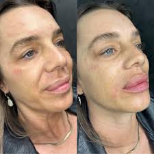 Profile for Fancy Aesthetics Med Spa