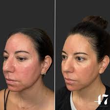 Cameron Bowling, BSN, RN (@injectorcam) • Instagram photos and videos