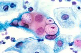 The incubation period is the time between being exposed to the virus and the onset of symptoms. Urethritis Inflammation Of Urethra Symptoms And Treatment Lecturio