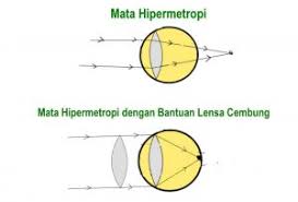 We did not find results for: Cacat Mata Dan Cara Menolongnya Isanggar