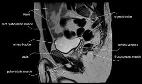 The muscular system is made up of specialized cells called muscle fibers. Male Pelvis Mri Introduction