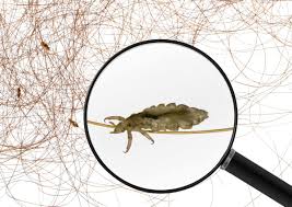 Will Bleach Kill Lice Here S What You Need To Know