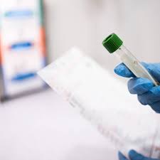 Die auf dieser seite abgebildeten daten der landesmeldestelle sind daher im allgemeinen aktueller als die des rki. Corona In Essen Aktuelle Zahlen Und Inzidenzwert Radio Essen