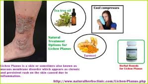 Pin On Lichen Planus