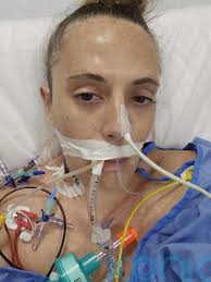 Woman who has not eaten normal meal for two years after Covid triggered  condition had to pay for life-changing surgery