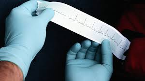 Image result for Ventricular Fibrillation Management in the Adult