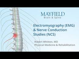 Electromyography Emg Nerve Conduction Studies Ncs