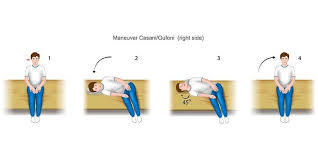 Image result for Canalith Repositioning Procedure