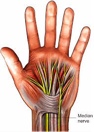 Carpal Tunnel Release Healthdirect